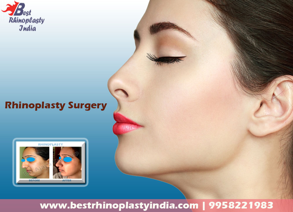 #rhinoplasty ,#rhinoplastycost, #rhinoplastyclinic, #nosesurgeon ,#nosejob, #bestnosesurgeon, #bestrhinoplastyindia, #nosereconstruction, #nasalsurgery